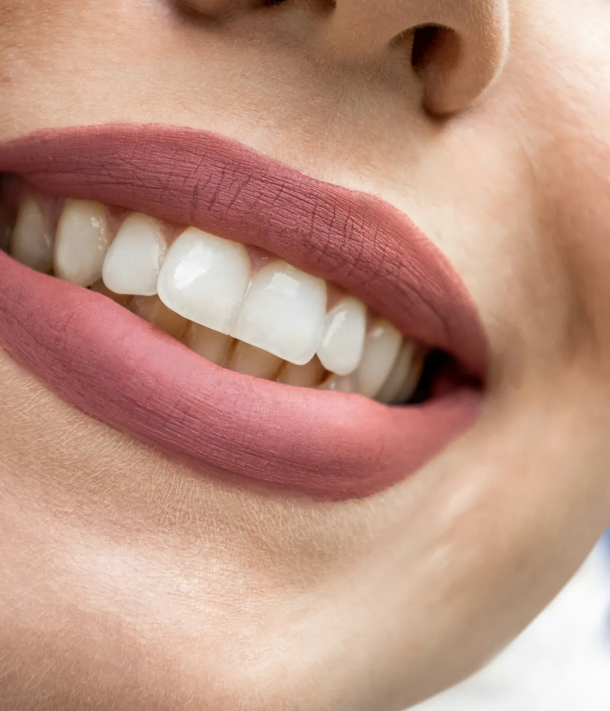 Sonrisa con dientes alineados y blancos
